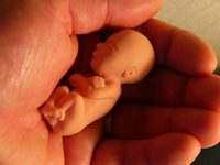abortusz.jpg